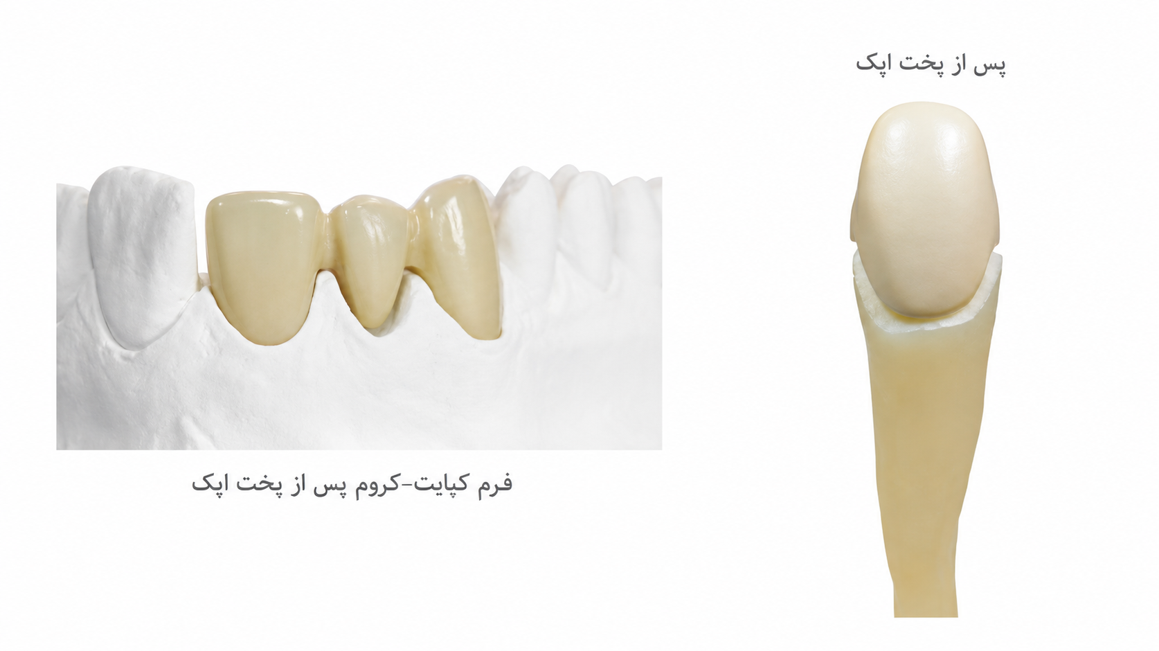اپک خمیری PFM افرند